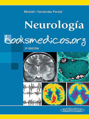 ebooks-neurologia-michelli.jpg