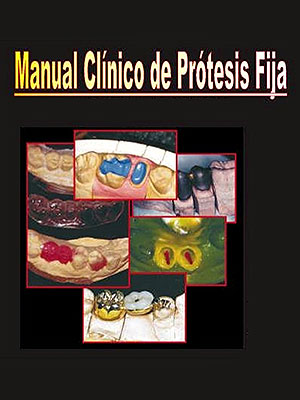 Manual clínico de prótesis fija