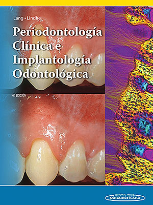 Periodontología clínica e implantología odontológica