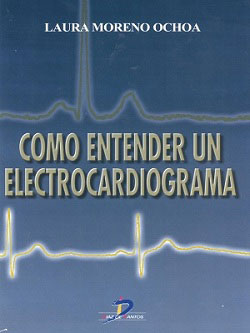 como entender un electrocardiograma