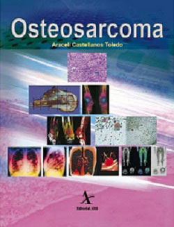 Osteosarcoma Araceli Castellanos Toledo