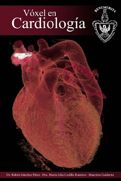 Vóxel en Cardiología