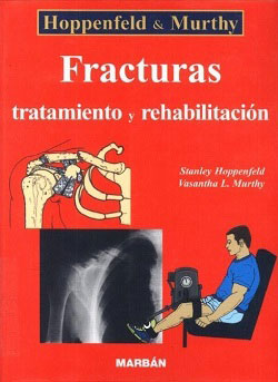 Fracturas, tratamiento y rehabilitación, Hoppenfeld & Murthy